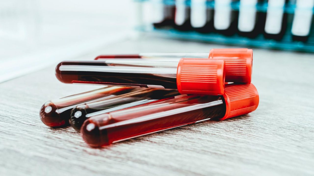 Da li su laboratorijske analize obavezne i koliko one koštaju?
