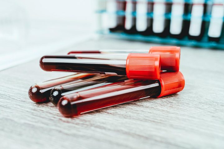 Da li su laboratorijske analize obavezne i koliko one koštaju?
