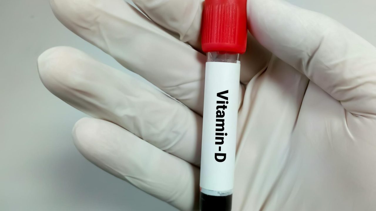 Kako proveriti nivo vitamina D?